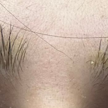 Loreal Paris C Vitamini Oksitlenme Problemi