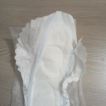 Molped Tekrarlayan Üretim Hatası Ve Müşteri Hayal Kırıklığı