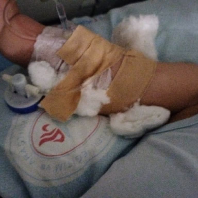 Kayseri Devlet Hastanesi Yetkililerin Görmesini İstiyorum Damar Yolu Açılıp Böyle Bırakılmaz