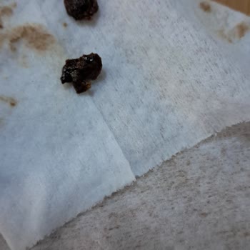 Eti Çikolata Yerken İçinden Tanımlanamayan Bir Şey Çıktı.