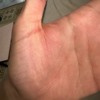 iPhone Isınma Problemi İphone