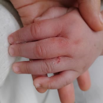 Ankara Etlik Şehir Hastanesi Hemşireler Çok Dikkatsizler