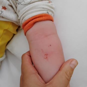 Ankara Etlik Şehir Hastanesi Hemşireler Çok Dikkatsizler