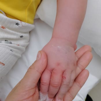 Ankara Etlik Şehir Hastanesi Hemşireler Çok Dikkatsizler