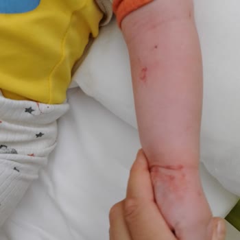 Ankara Etlik Şehir Hastanesi Hemşireler Çok Dikkatsizler