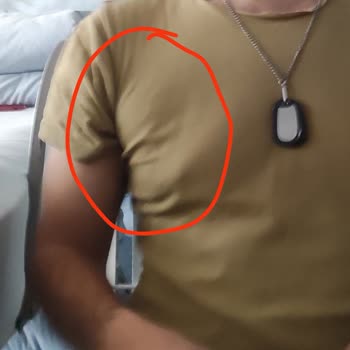 Özel Bilge Hastanesi Başarısız Operasyon, İletişimsizlik, İlgisizlik