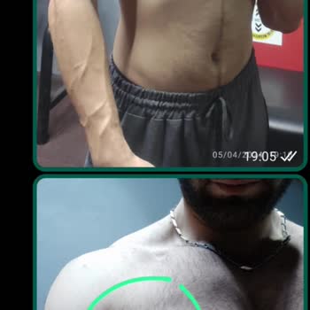 Özel Bilge Hastanesi Başarısız Operasyon, İletişimsizlik, İlgisizlik