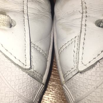 adidas Üretim Hatası Sol Büyük Sağ Küçük