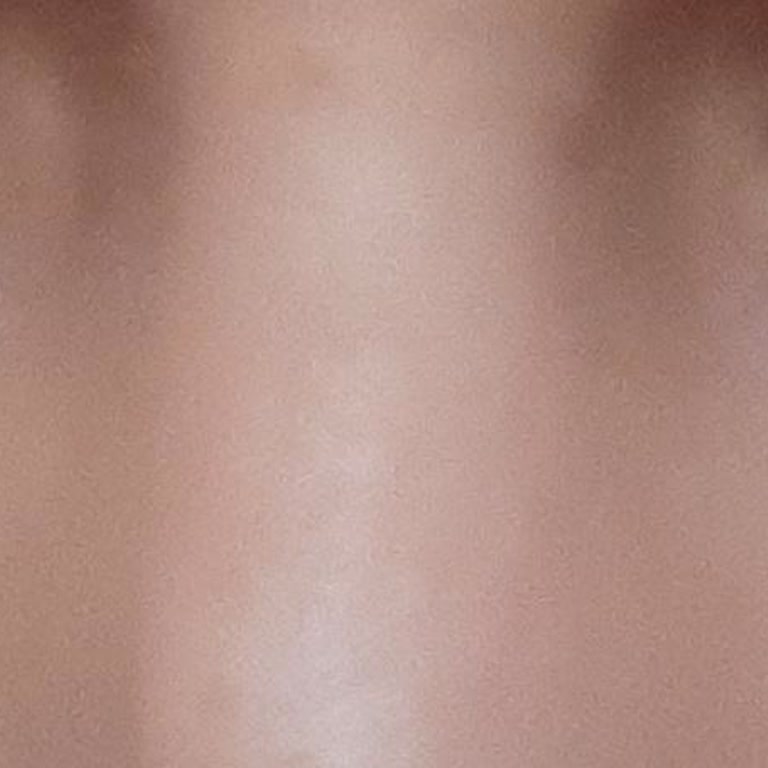 Newgen Gözaltı Serumunun Morluk Oluşturması