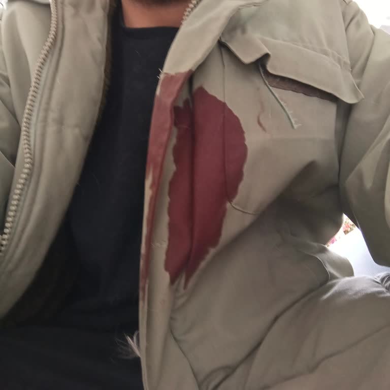 Çorlu Belediyesi Çorluda Başıboş Saldırgan Köpekler!