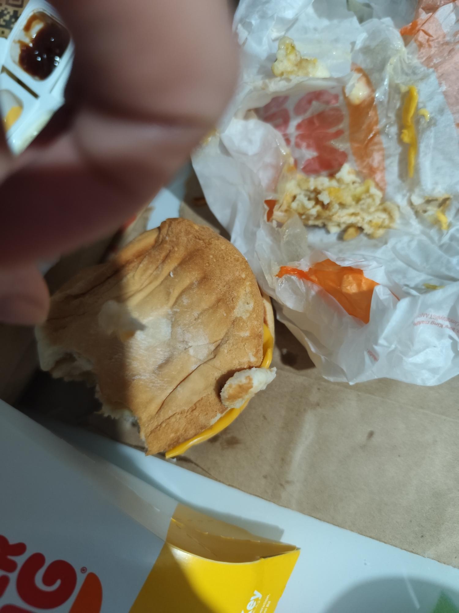 Discovered Hair in My Burger King Burger Xolvie