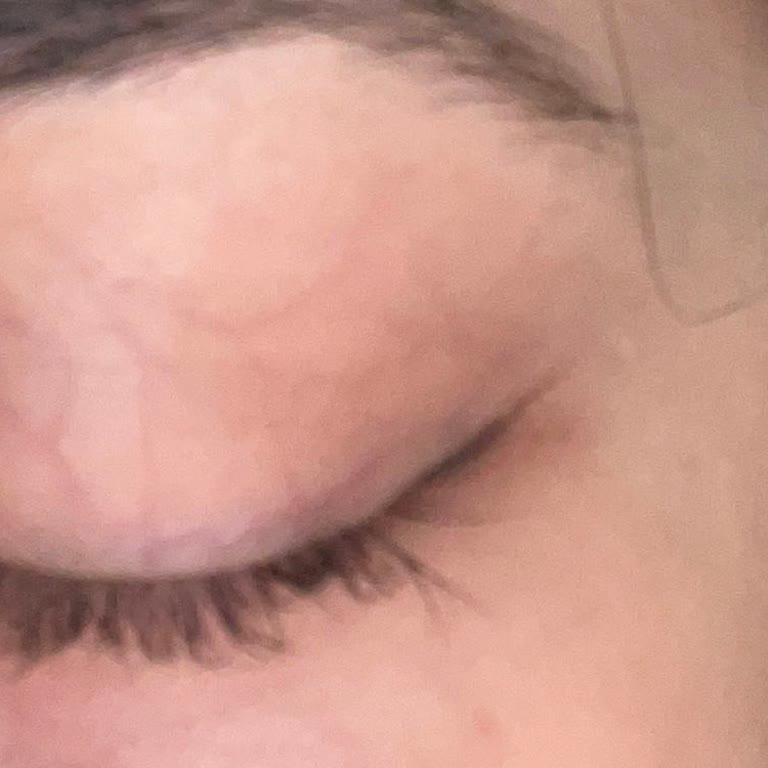 Aymira Koçaklı Yaşam Merkezi Liftingle Kirpiklerim Mahvoldu