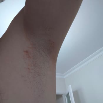 PHILIPS Philips 15 İ Bir Arada Saç Sakal Makinesi