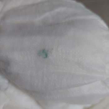 Baby Turco Bebek Bezi İçerisinden Çıkanlar