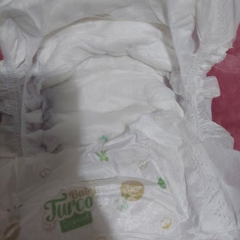 Baby Turco Bebek Bezi İçerisinden Çıkanlar