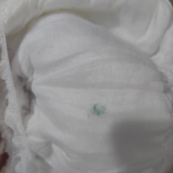 Baby Turco Bebek Bezi İçerisinden Çıkanlar