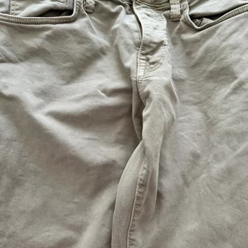 Vanish Kosla Leke Çıkarıcının Bıraktığı 'leke'