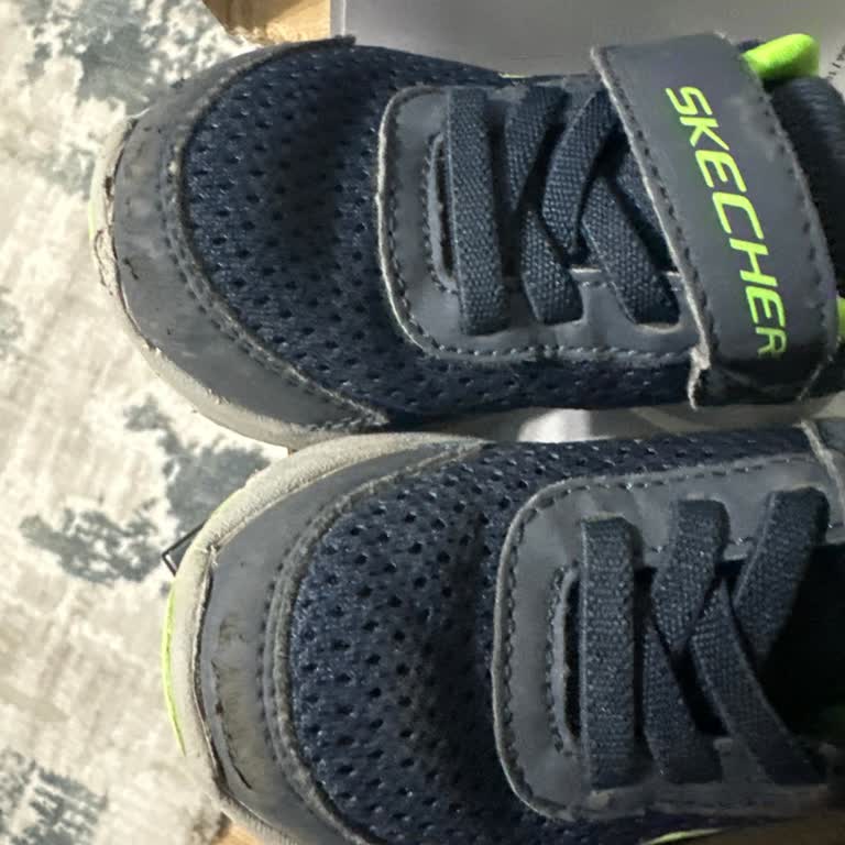Skechers 3 Ayda Bozulan Ayakkabı!