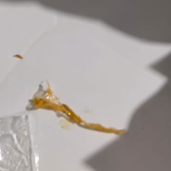 Sr Döner Dönerden Streç Parçası Çıktı