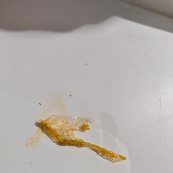 Sr Döner Dönerden Streç Parçası Çıktı