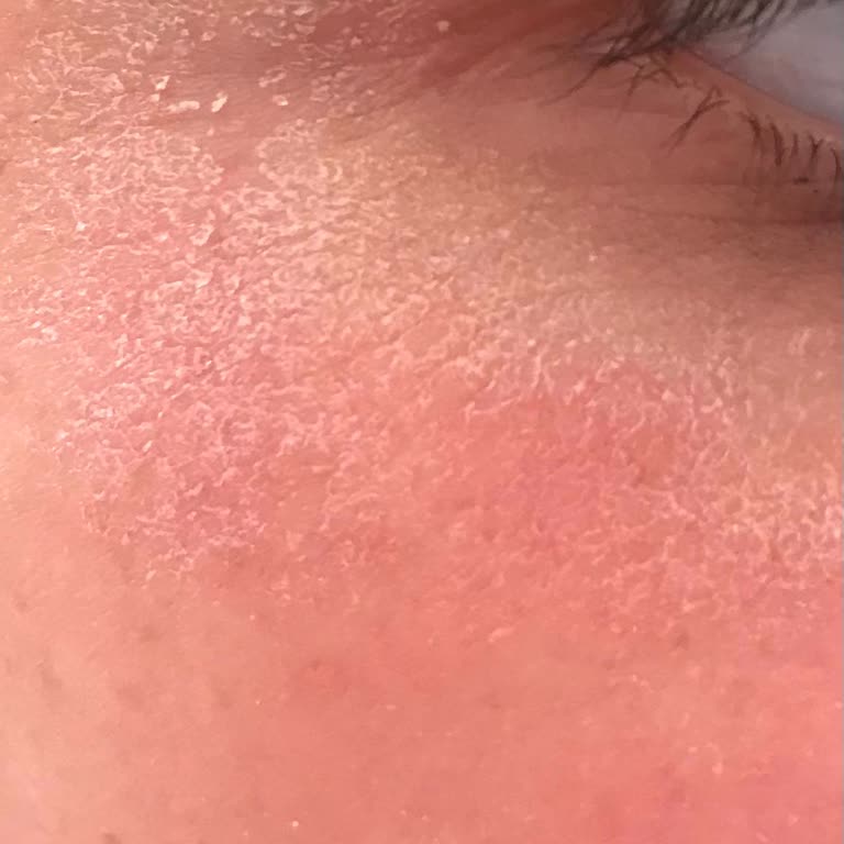 Maruderm Maruz Derm Şikayet