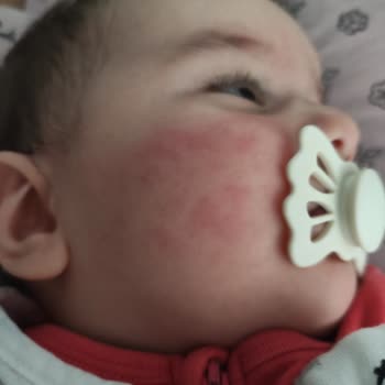 Mustela Ürünleri Şikayet Başvurusu