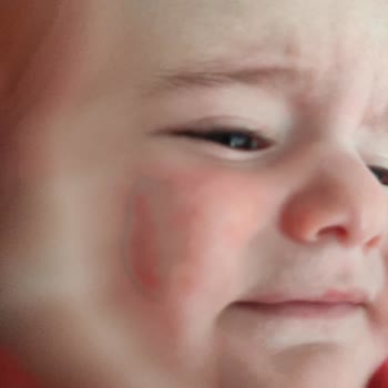 Mustela Ürünleri Şikayet Başvurusu