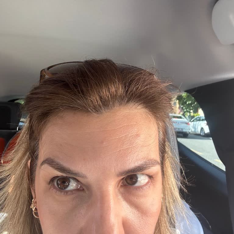 Okan Üniversitesi Hastanesi Botoks İşleminde Beklenmedik Sonuçlar