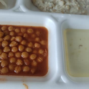 Bandırma Eğitim Ve Araştırma Hastanesi'nin Yemeklerinde Hijyen Sorunu!