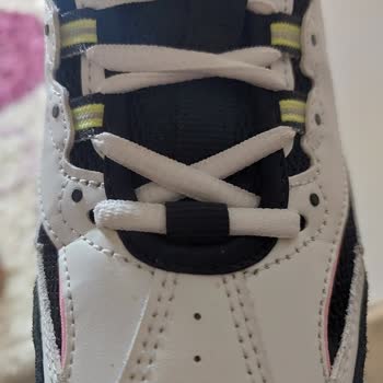 Skechers Ürünün Arkasında Durmuyor