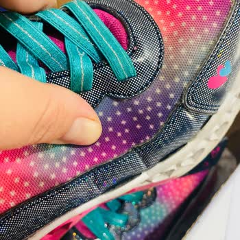 Skechers Ürünün Arkasında Durmuyor!