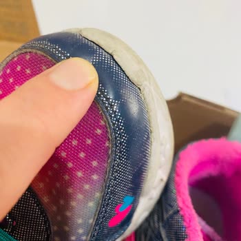 Skechers Ürünün Arkasında Durmuyor!