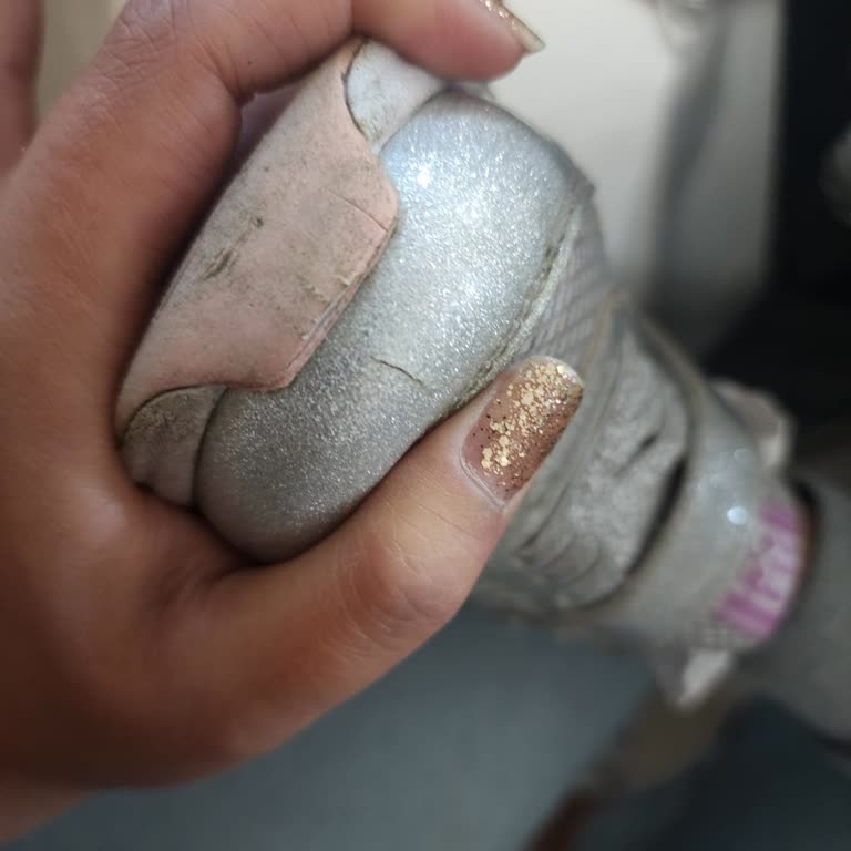 Minipicco Spor Ayakkabı Yırtılması