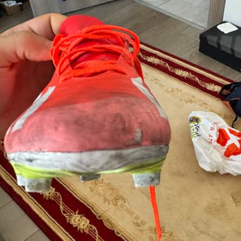 Adidas Ve Boyner Kalitesiz Ürünler