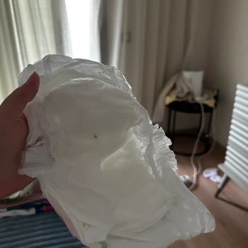 Baby Turco Bezdeki Yabancı Bir Madde