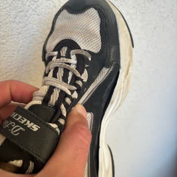 Skechers (Olka Spor) Malının Arkasında Durmuyor!
