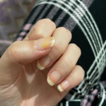 Flormar Oje Tırnağımda Sarı Leke Bıraktı