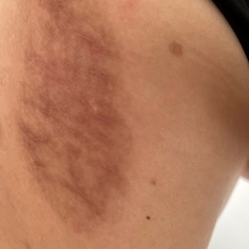 Zendora Deluxe Kristal Peeling Yanık