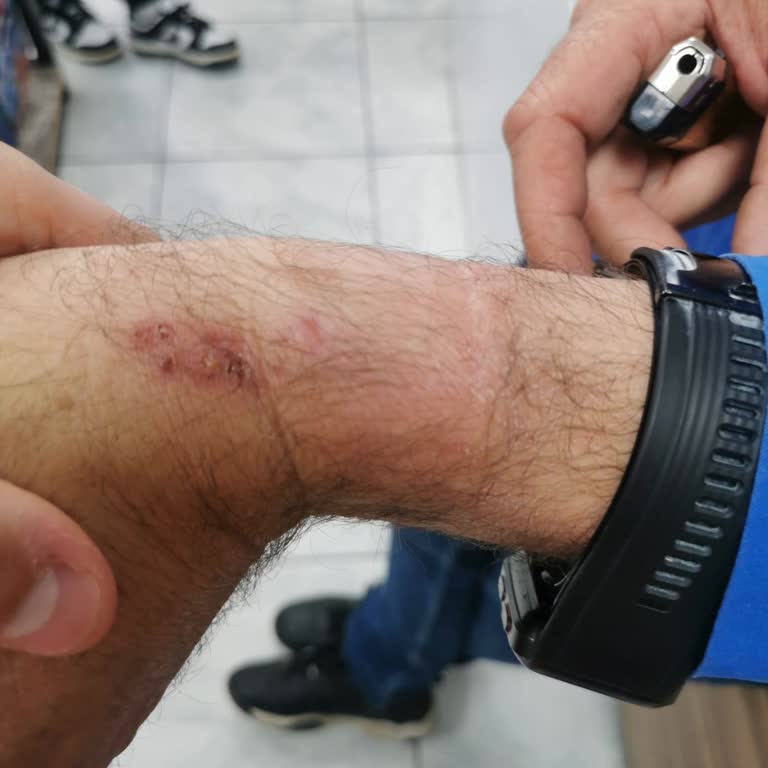 Huawei Watch D Mağduriyet