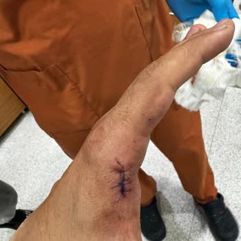 Michelin Michel Bizi Ölüme Götürdü