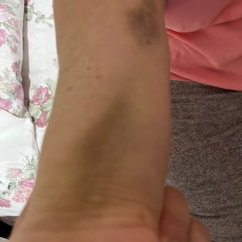 Medipol Mega Hastanesi Dehşet Gecesi