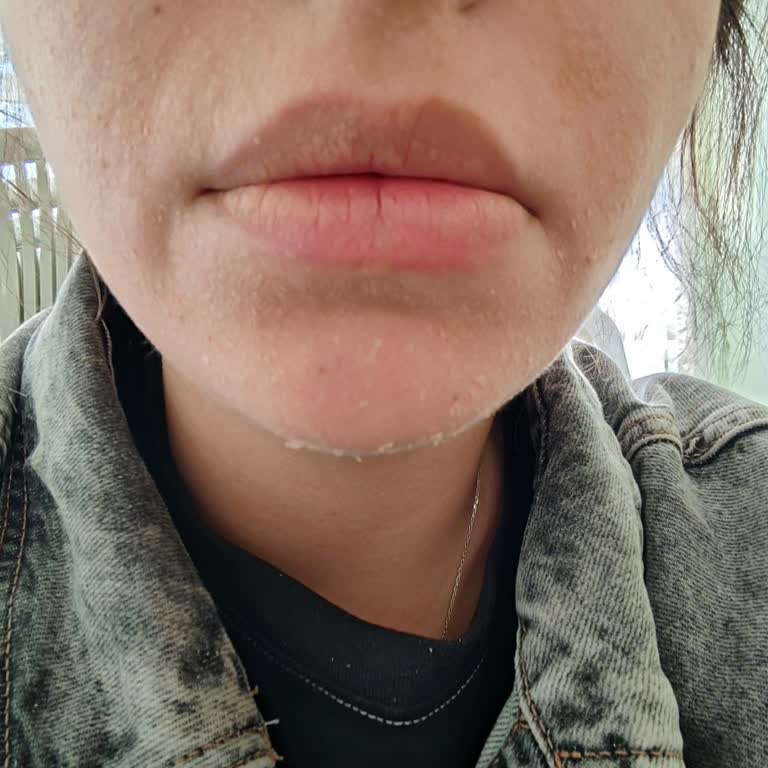 Bee Beauty Güneş Kreminin Beklenmedik Tepkisi