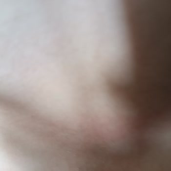 Molfix Pure Soft Bebek Bezi Çocuğumda Kaşıntı Ve Tahrişe Sebep Oldu