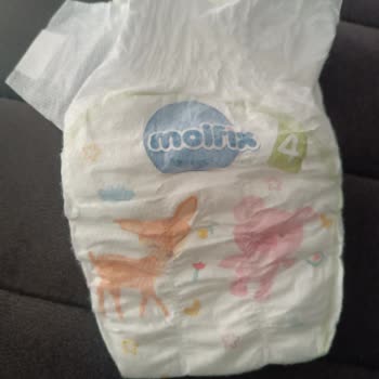 Molfix Pure Soft Bebek Bezi Çocuğumda Kaşıntı Ve Tahrişe Sebep Oldu