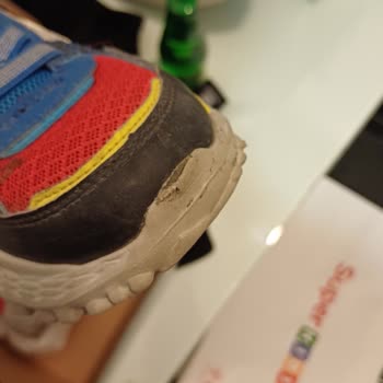 Skechers Ayakkabı 1 Ayda Burnu Açıldı Kalite Git Gide Düşüyor