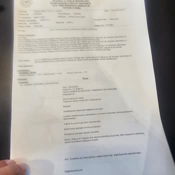 Aksigorta Kasko Kazası Ve Onay Sürecinde Yaşanan Sorunlar