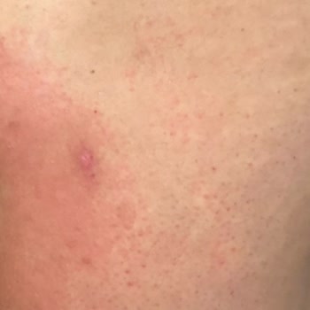 Gaziosmanpaşa Minty Güzellik Merkezi Lazer Epilasyon