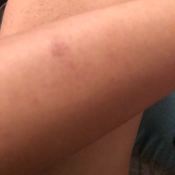 Gaziosmanpaşa Minty Güzellik Merkezi Lazer Epilasyon