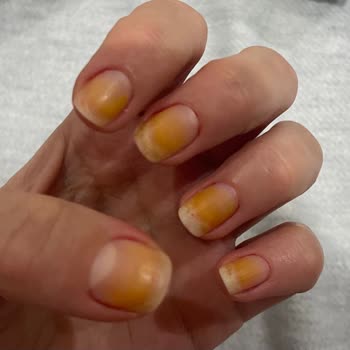 Flormar Oje Tırnaklarımı Mahvetti!