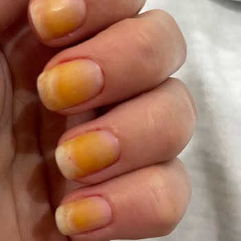 Flormar Oje Tırnaklarımı Mahvetti!